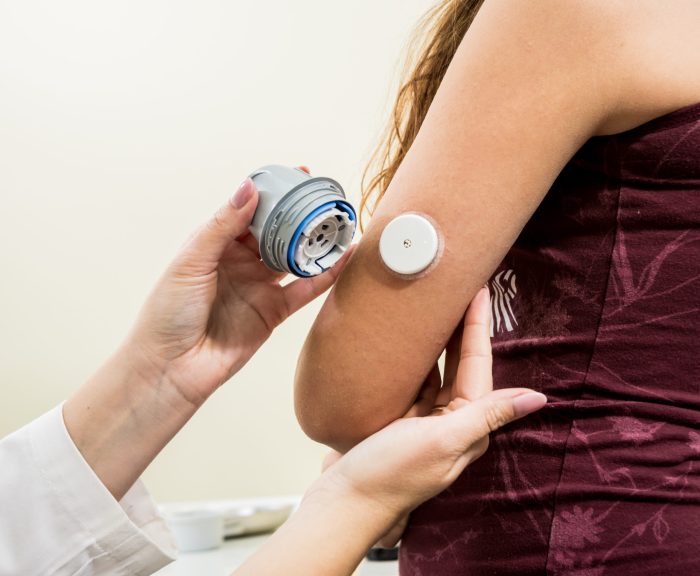 Patch monitor glucose levels exercise