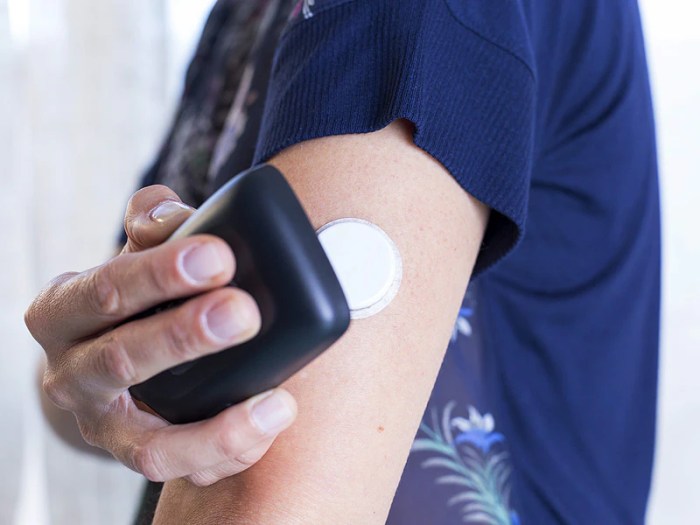 Patch monitor glucose levels exercise